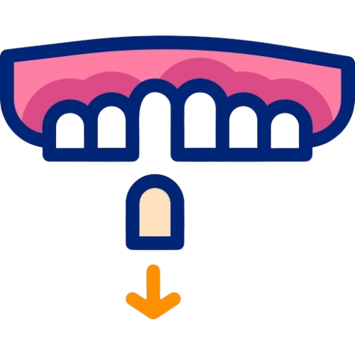 shows Avulsed tooth as a symbol of dental Emergency